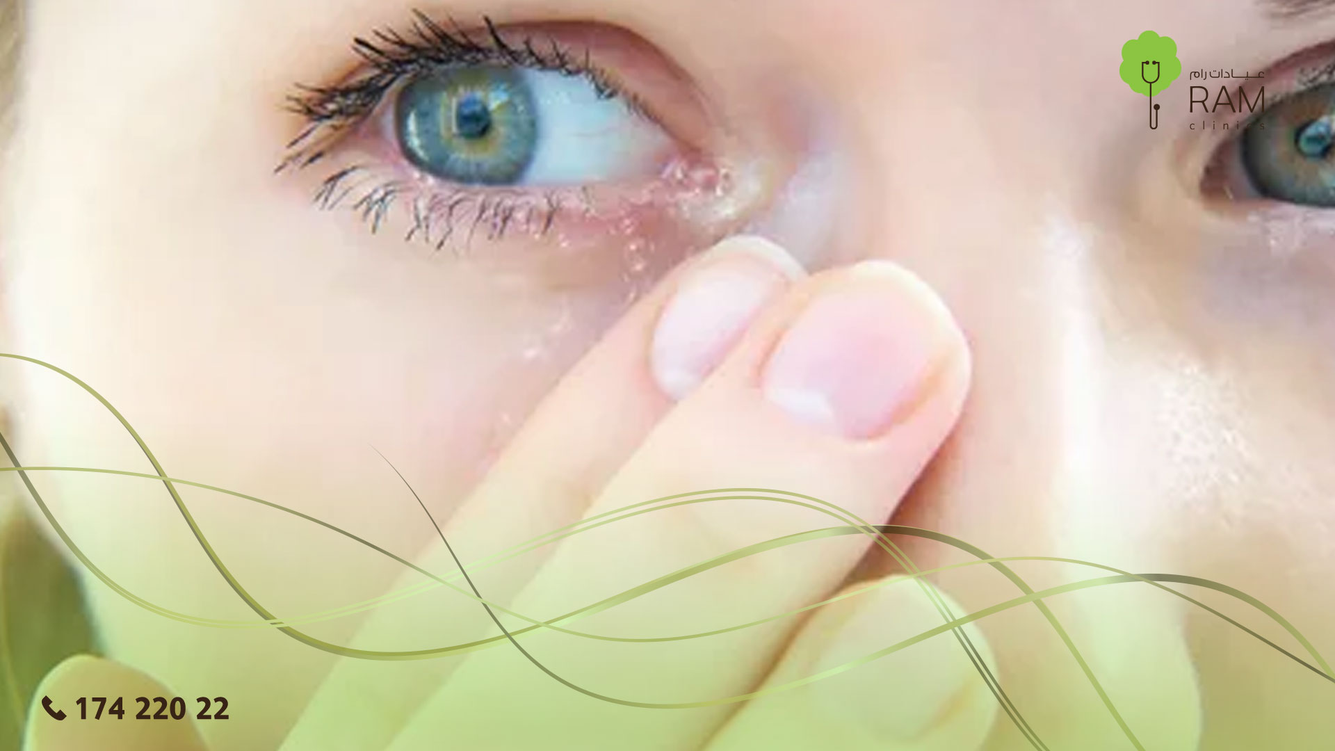 أمراض العيون