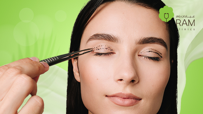 الجفن المزدوج