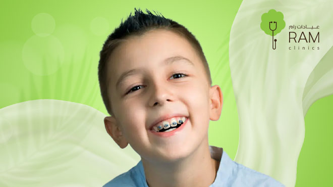 تقويم الأسنان عند الأطفال