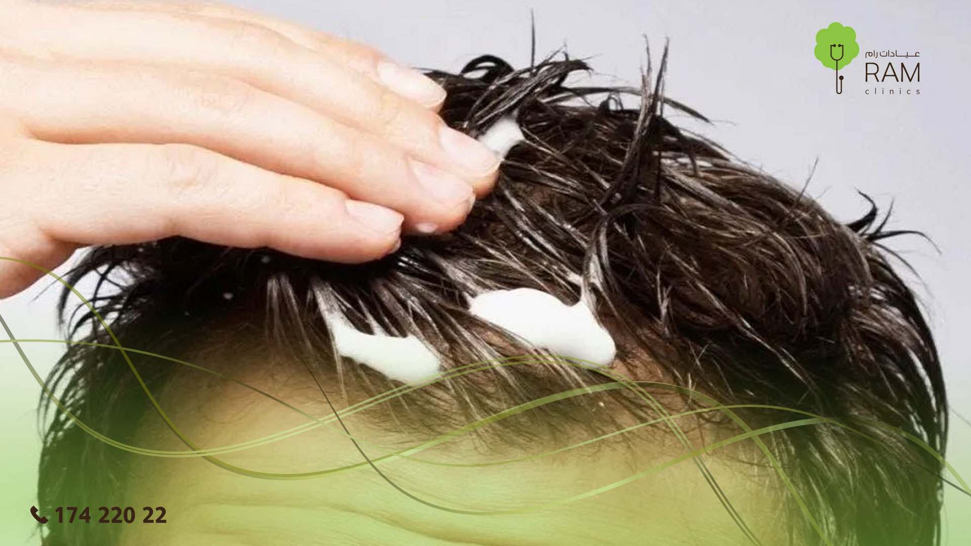 العناية بالشعر للرجال