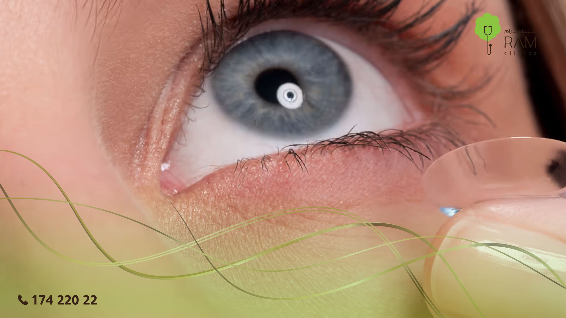 العدسات اللاصقة