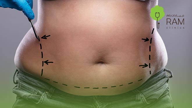 كيفية عملية شفط الدهون في البحرين: الإجراءات والأسعار