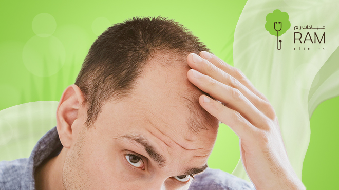 علاج-ثعلبة-الشعر