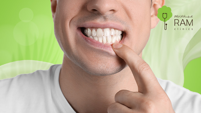 قص-اللثة-بالليزر