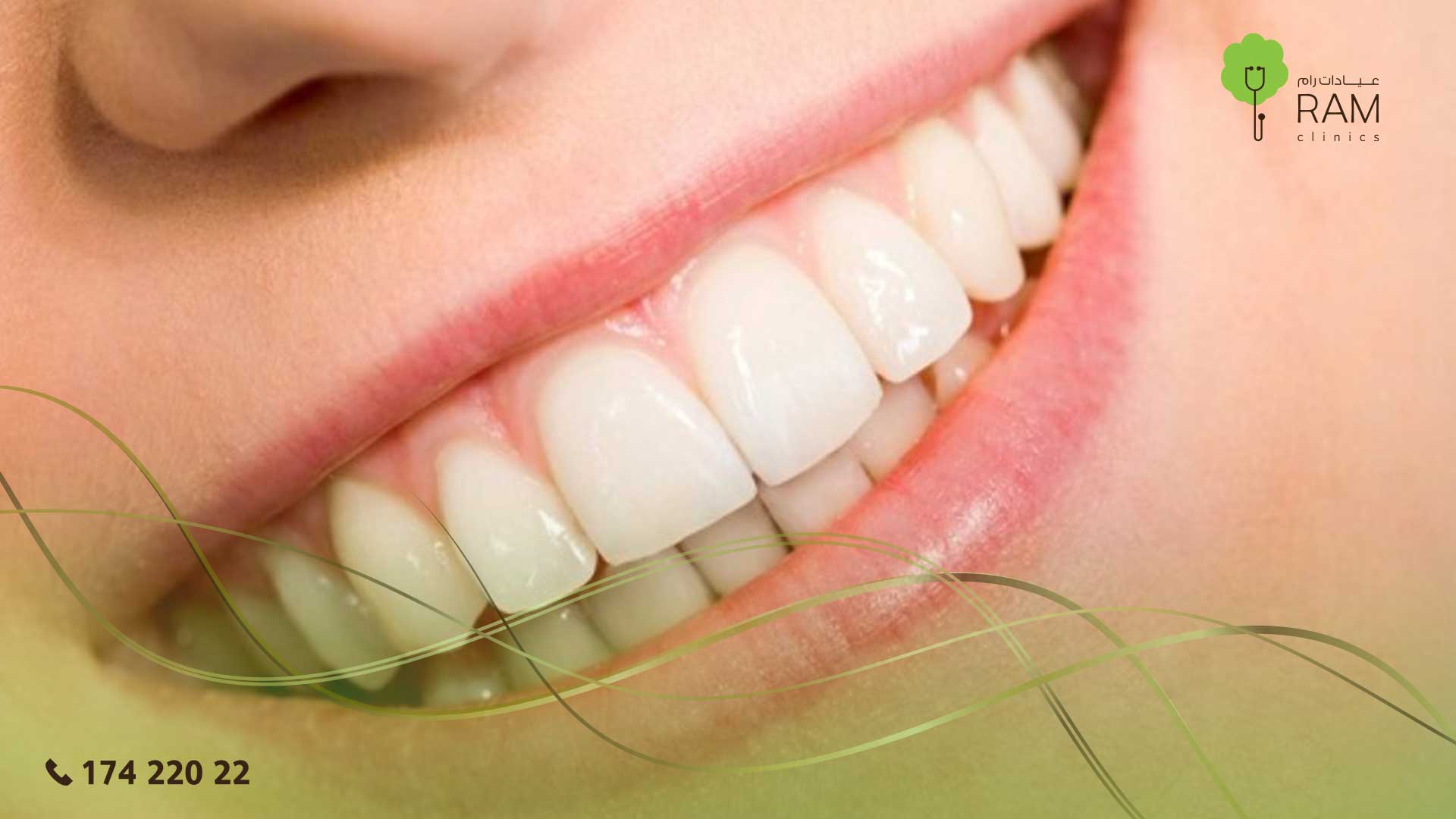 تعرف علي تجميل الأسنان