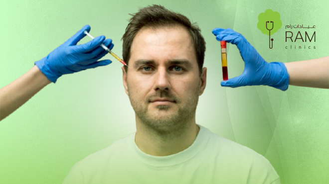 حقن-البلازما-لتساقط-الشعر
