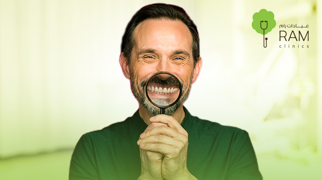 عدسات-الفينير-للاسنان