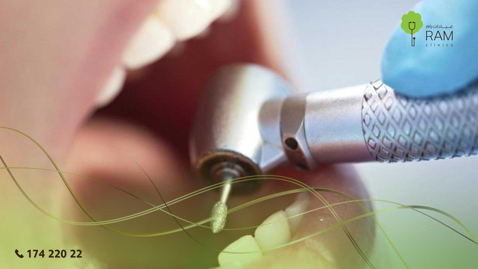 طرق تنظيف الاسنان