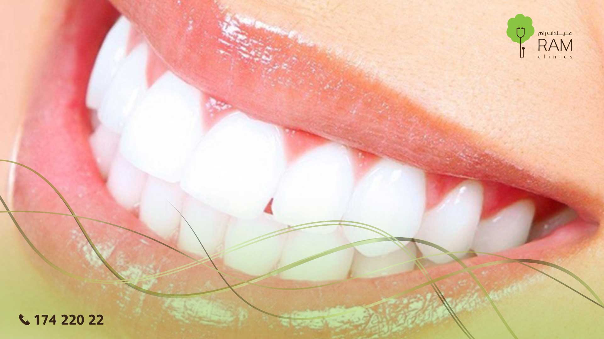 تبيض الأسنان بالمنزل