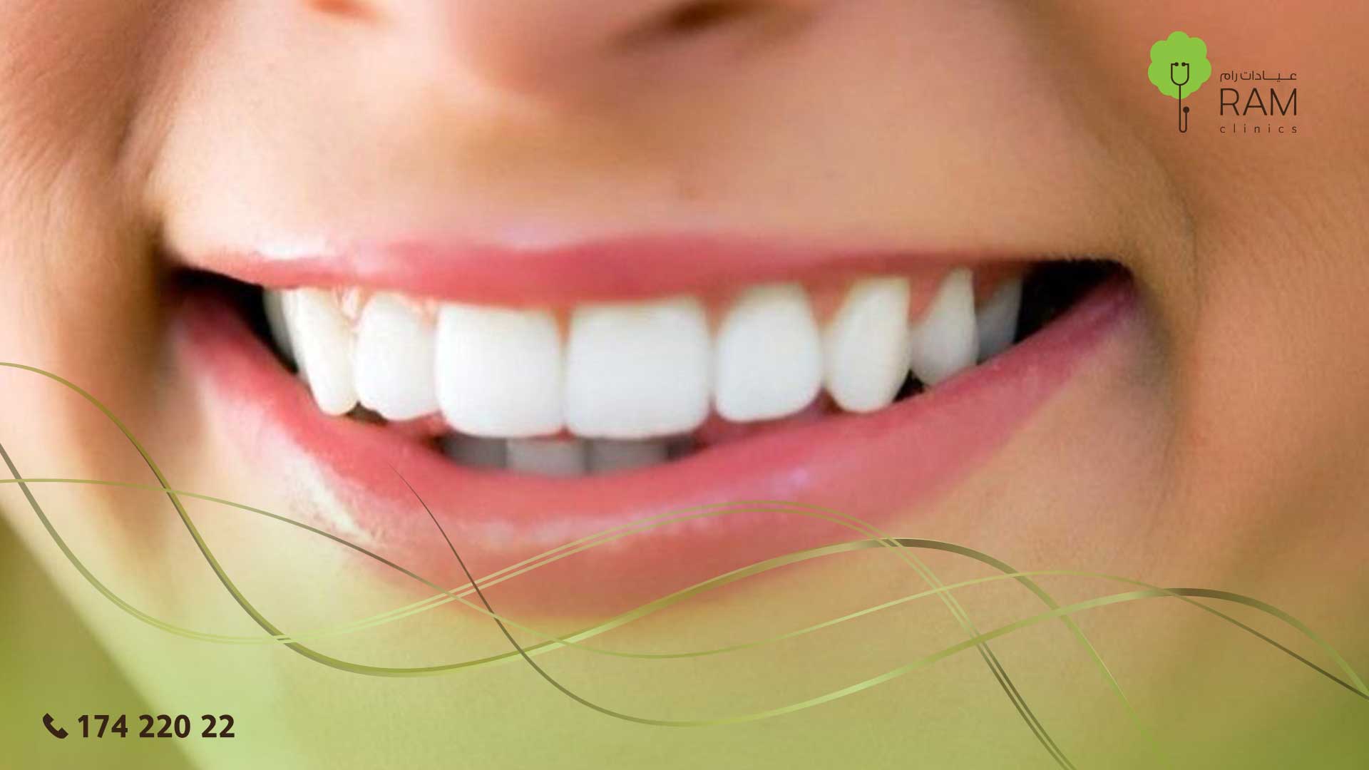 تنظيف وتبييض الأسنان