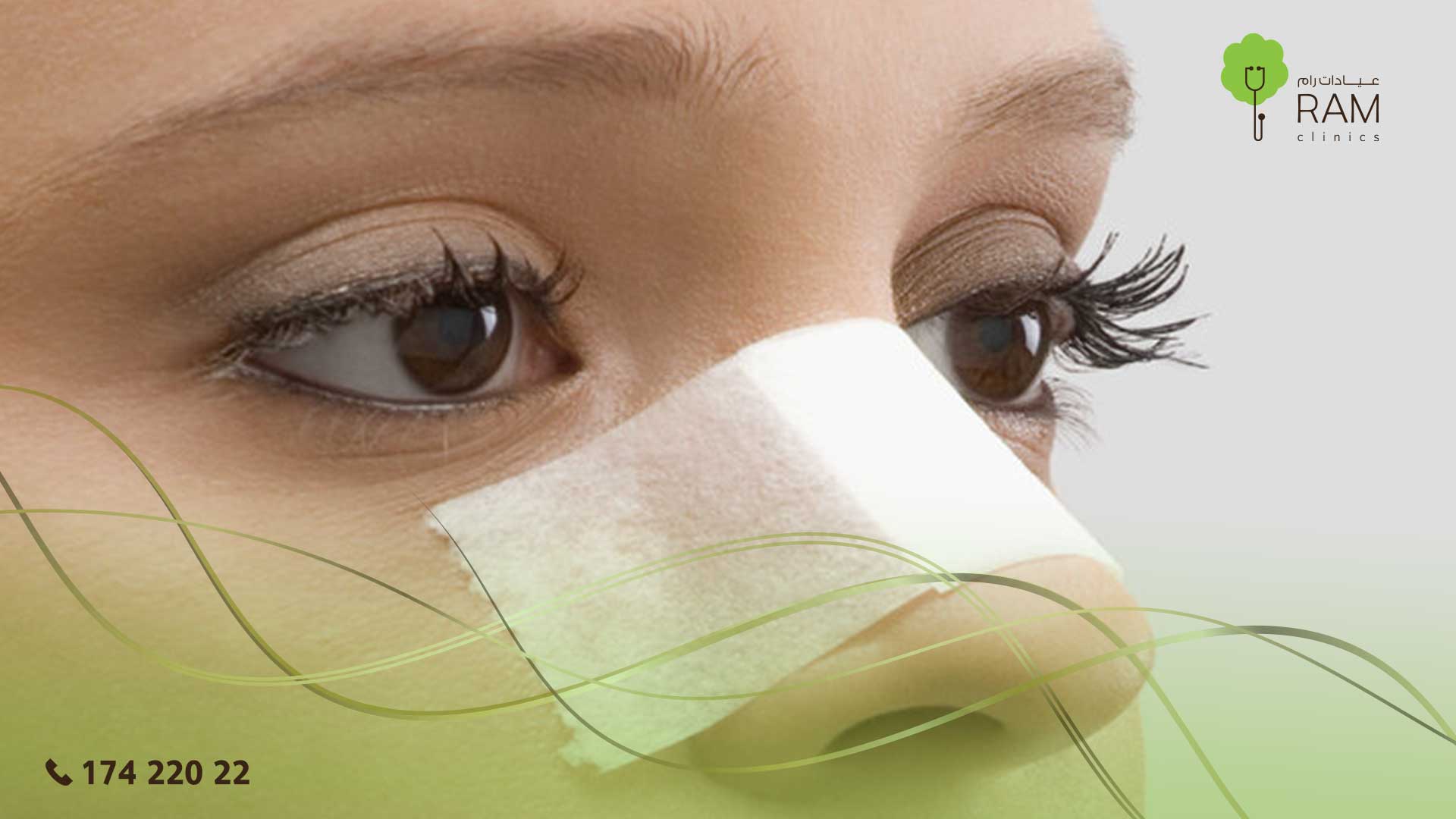 تجميل الأنف