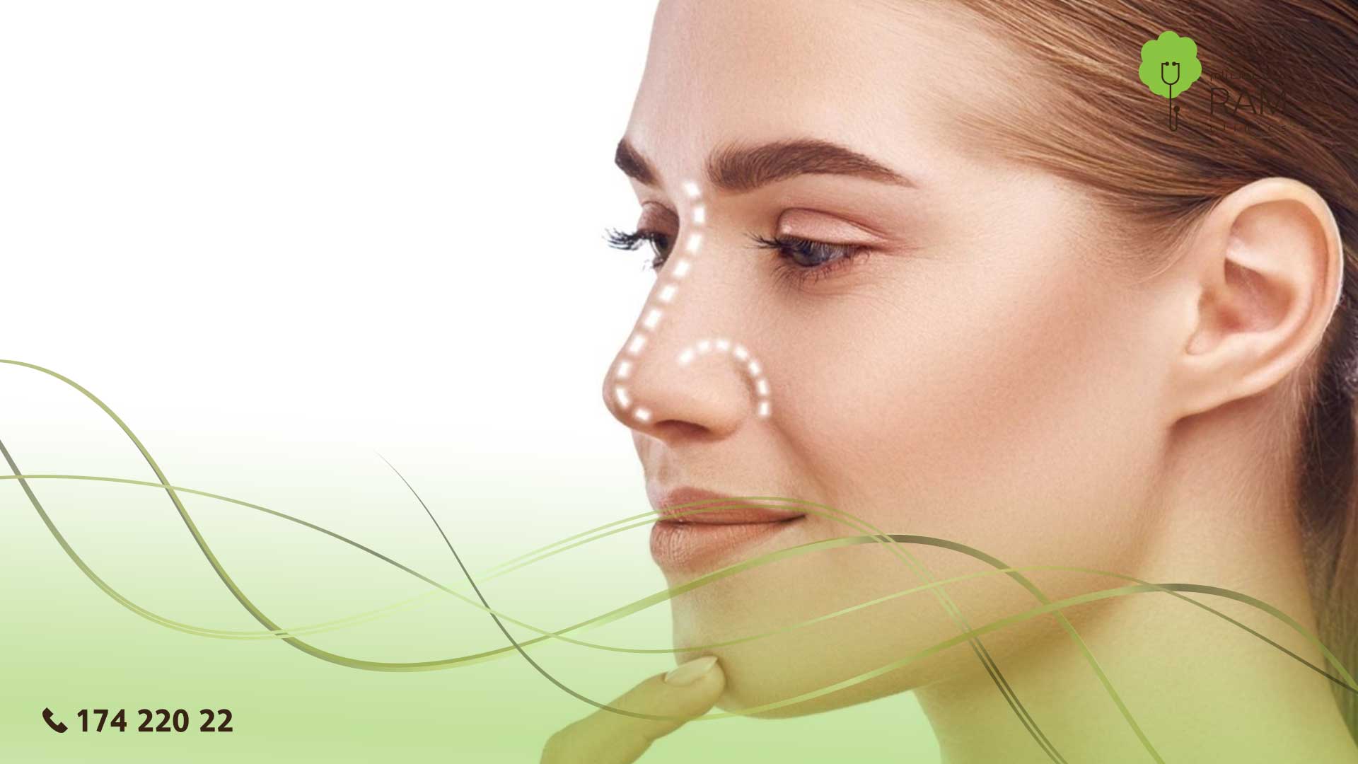 تجميل الأنف بدون جراحة