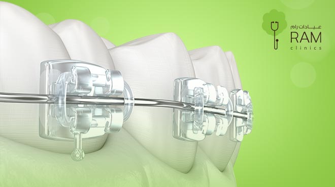 فوائد-التقويم-الشفاف