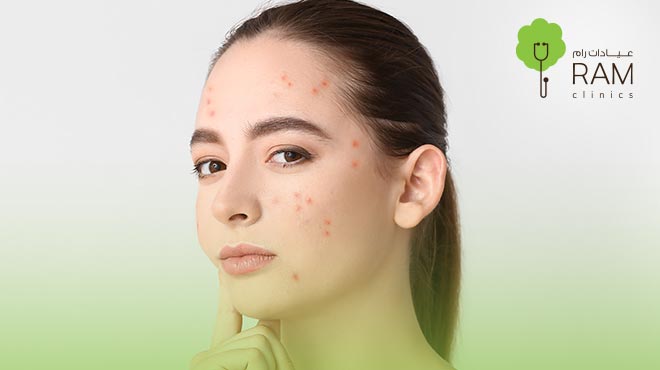 متخصصون-العناية-بالبشرة متخصصون-العناية-بالبشرة