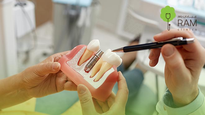 أسعار-زراعة-الأسنان-في-البحرين