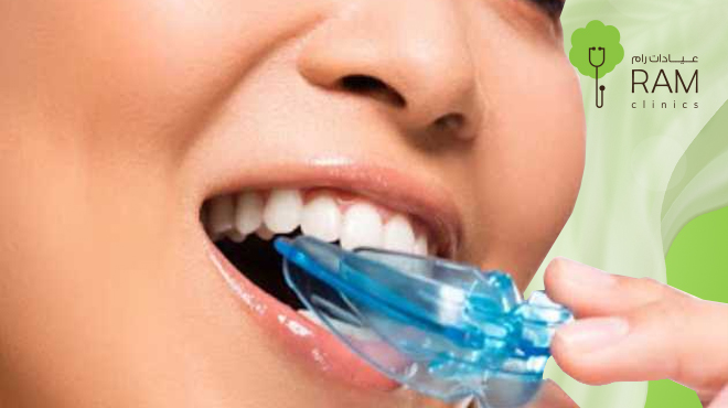 حل-صرير-الاسنان