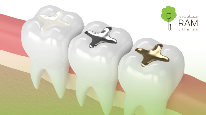 تسكين-ألم-الأسنان-أثناء الصيام تسكين-ألم-الأسنان-أثناء الصيام