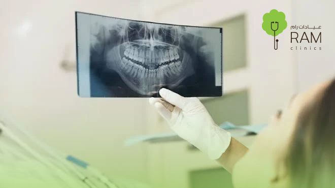 أشعة-البانورما