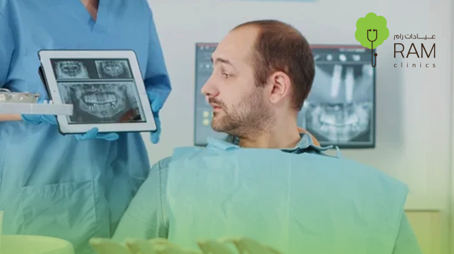 أشعة-البانورما