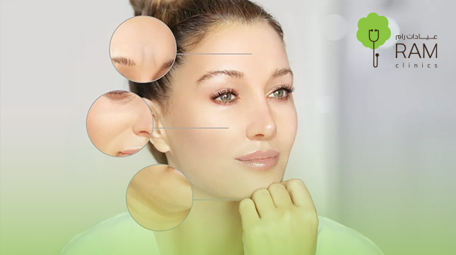  بوتكس-اليرجان 