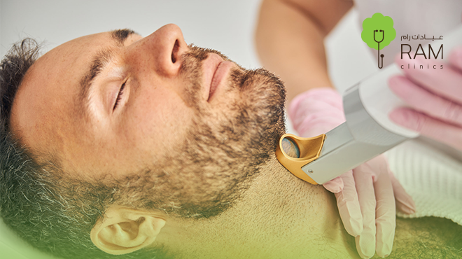 تحديد-اللحية-بالليزر