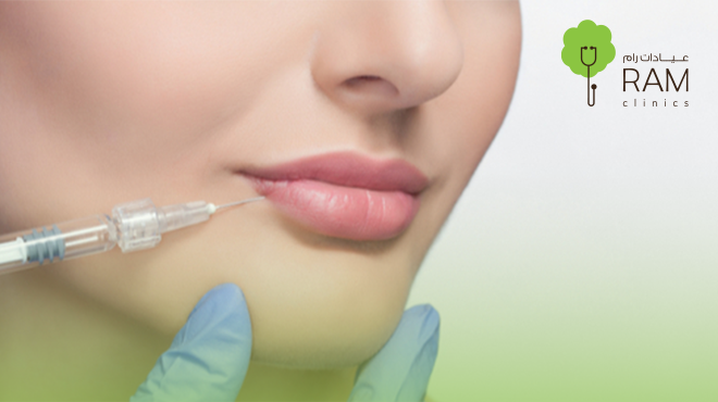 فيلر جوفيديرم للشفايف فيلر-جوفيديرم