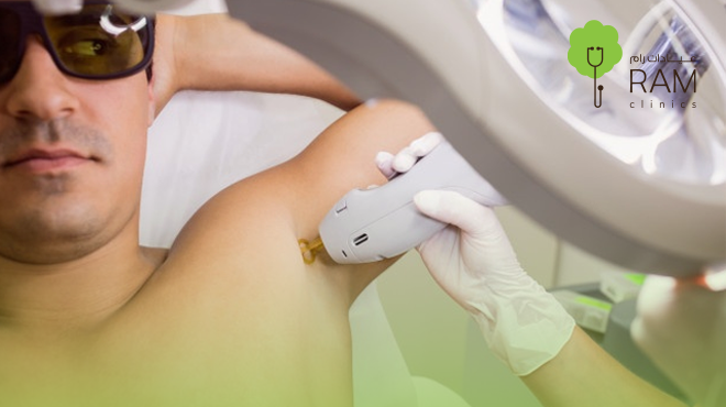 ليزر-للجسم-للرجال