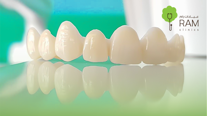 تلبيسة-الزيركون