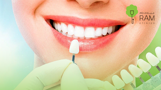 تلبيسة-الزيركون