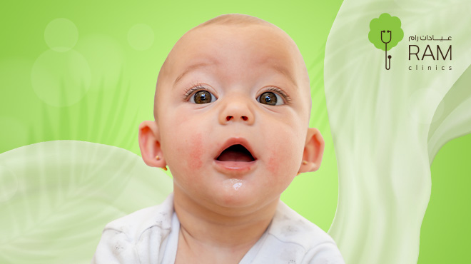 أسباب-الإكزيما-عند-الأطفال