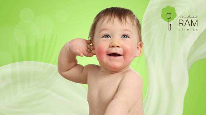 أسباب-الإكزيما-عند-الأطفال