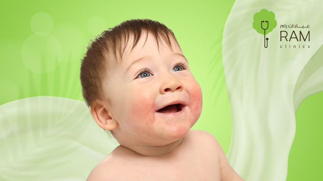 أسباب-الإكزيما-عند-الأطفال