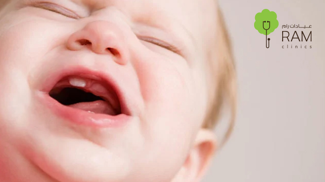 اعراض-التسنين