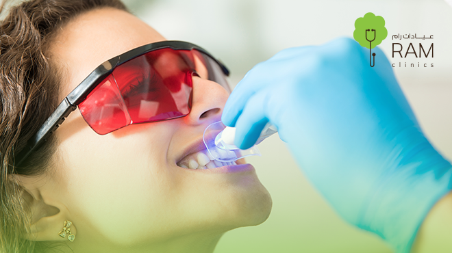 تنظيف-وتبييض-الأسنان تنظيف-وتبييض-الأسنان