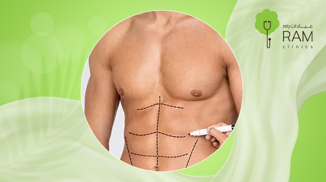 شفط-الدهون-بالفيزر