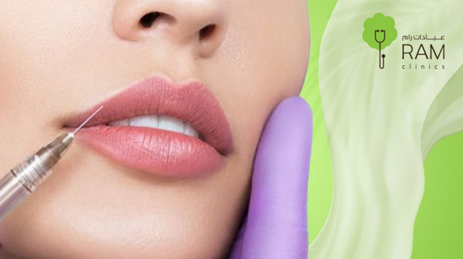 انواع-فيلر-الشفايف انواع-فيلر-الشفايف