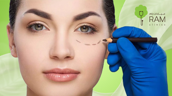 فيلر-تحت-العين فيلر-تحت-العين