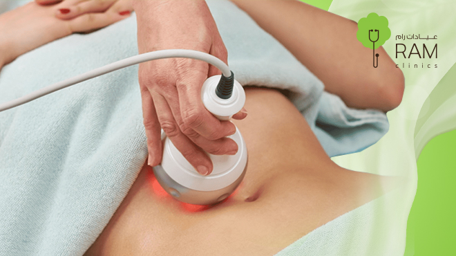 شفط-الدهون-بالليزر