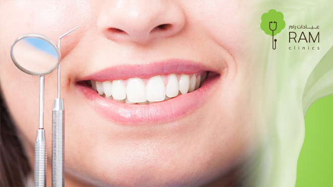 فيلر-خطوط-الابتسامة