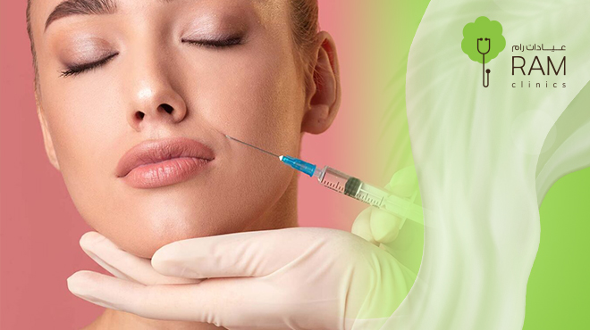 فيلر-خطوط-الابتسامة