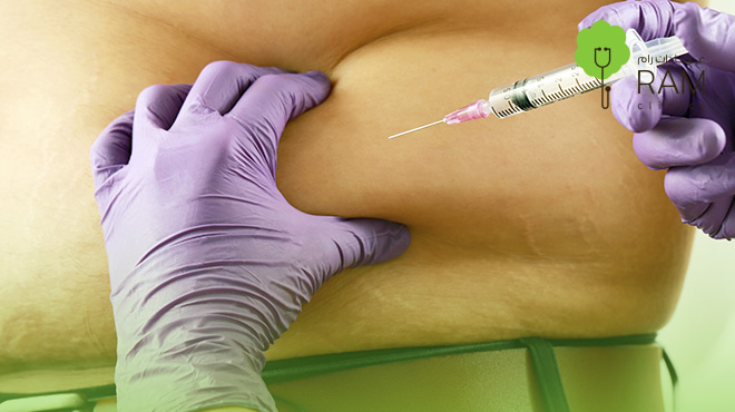 تجارب-حقن-الدهون-الذاتية