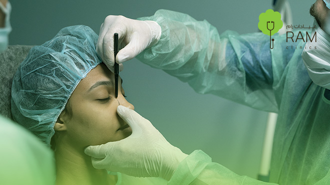 عملية-شد-الجفون