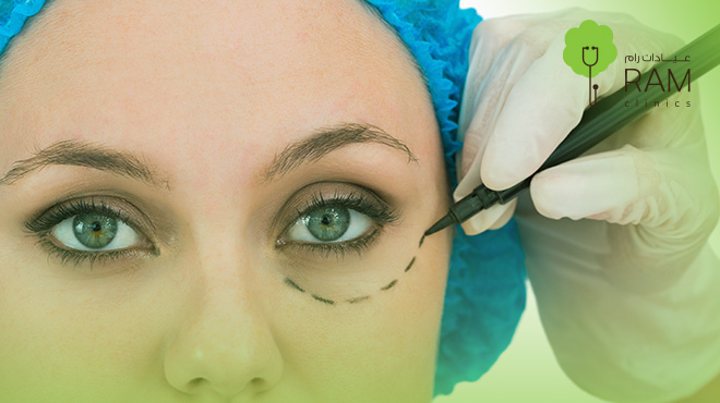 شكل-العين-بعد-عملية-شد-الجفون