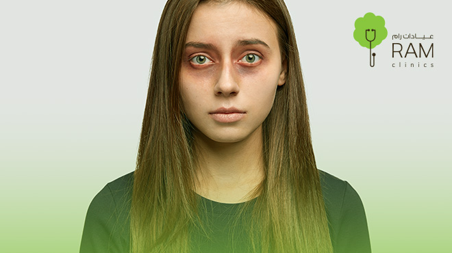 أسباب-فشل-عملية-شد-الجفون