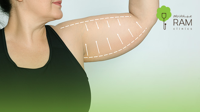 عملية-شد-الذراعين