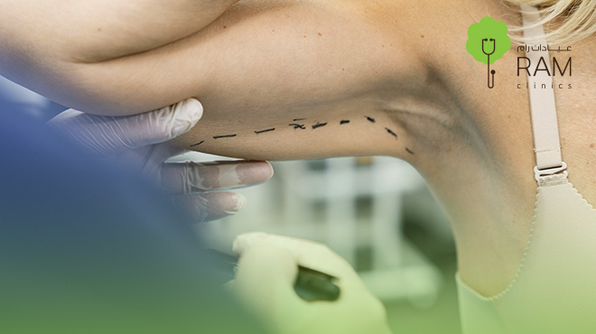 عملية-شد-الذراعين