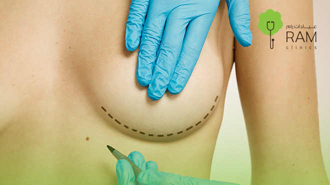 ترميم-الثدي-بعد-استئصاله