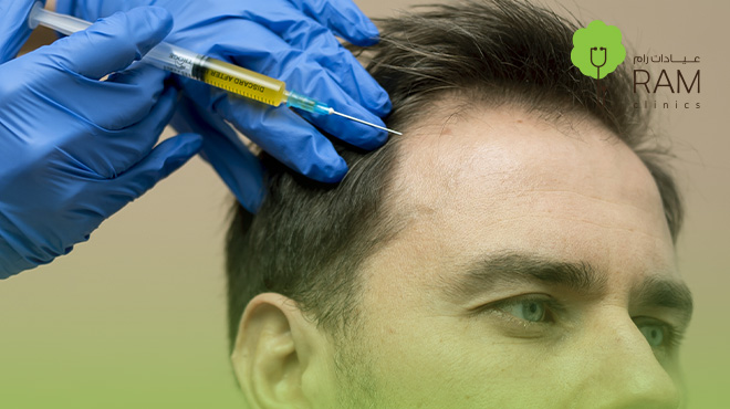 حقن-البلازما-لتساقط-الشعر
