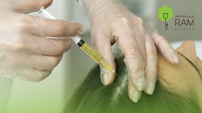 حقن-بلازما-الشعر