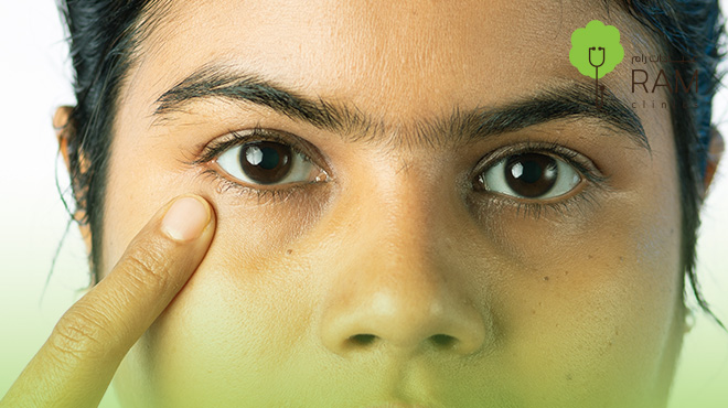 تفتيح-الهالات-السوداء-من-اول-مره